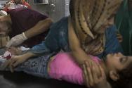 阿勒颇医院，一名受伤儿童正在接受治疗。