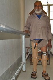 孟加拉国，萨瓦尔，瘫痪者康复中心。在靠一对脚凳行走25年后，法伊祖勒•哈克在康复中心员工的殷切目光中学着用假肢走路。