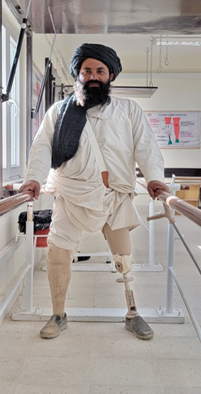  A man is standing as he tries to walk on his prosthetic leg.