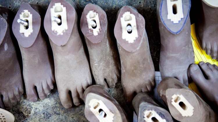 جنوب السودان: ساق اصطناعية تقهر الإعاقة