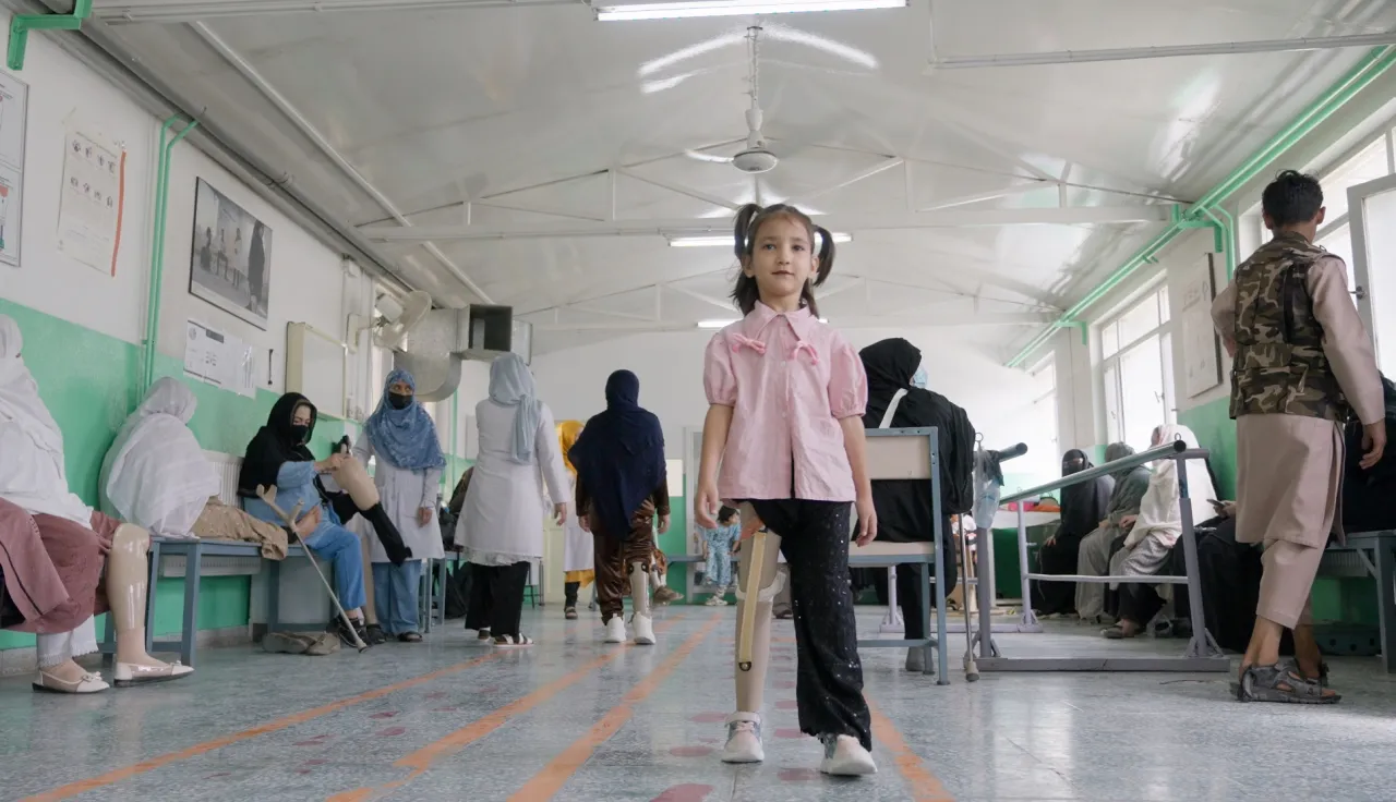Nazja, a young girl with a prosthetic leg, is standing in a medical facility.