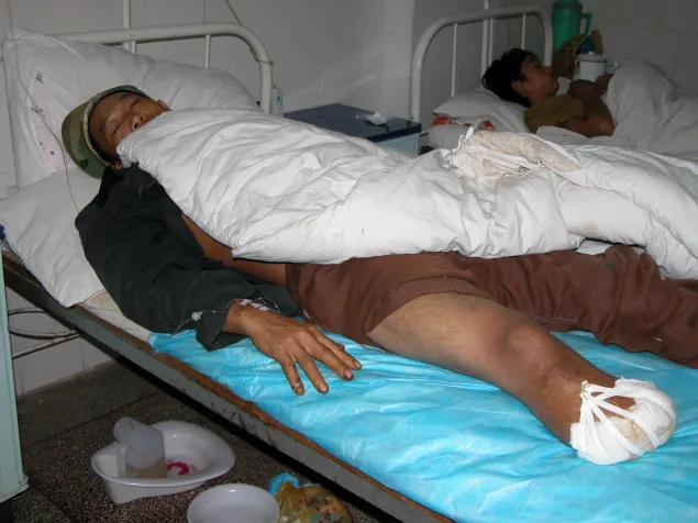 Yunnan. Orthopaedic rehabilitation centre in cooperation with ICRC.
