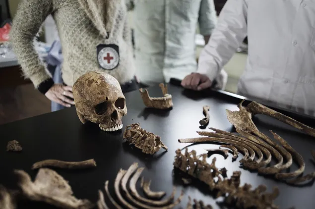 Colombia, Mayo de 2013. Instituto Nacional de Medicina Legal y Ciencias Forenses.  Proceso de análisis e identificación del esqueleto de una persona desaparecida en el año 2013