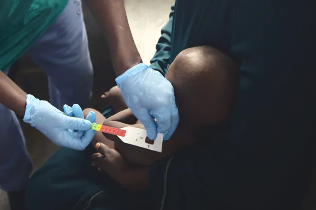 A child under five years gets an arm check up at triage.