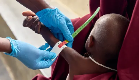 Stabilization Centre in Kismayo General Hospital
