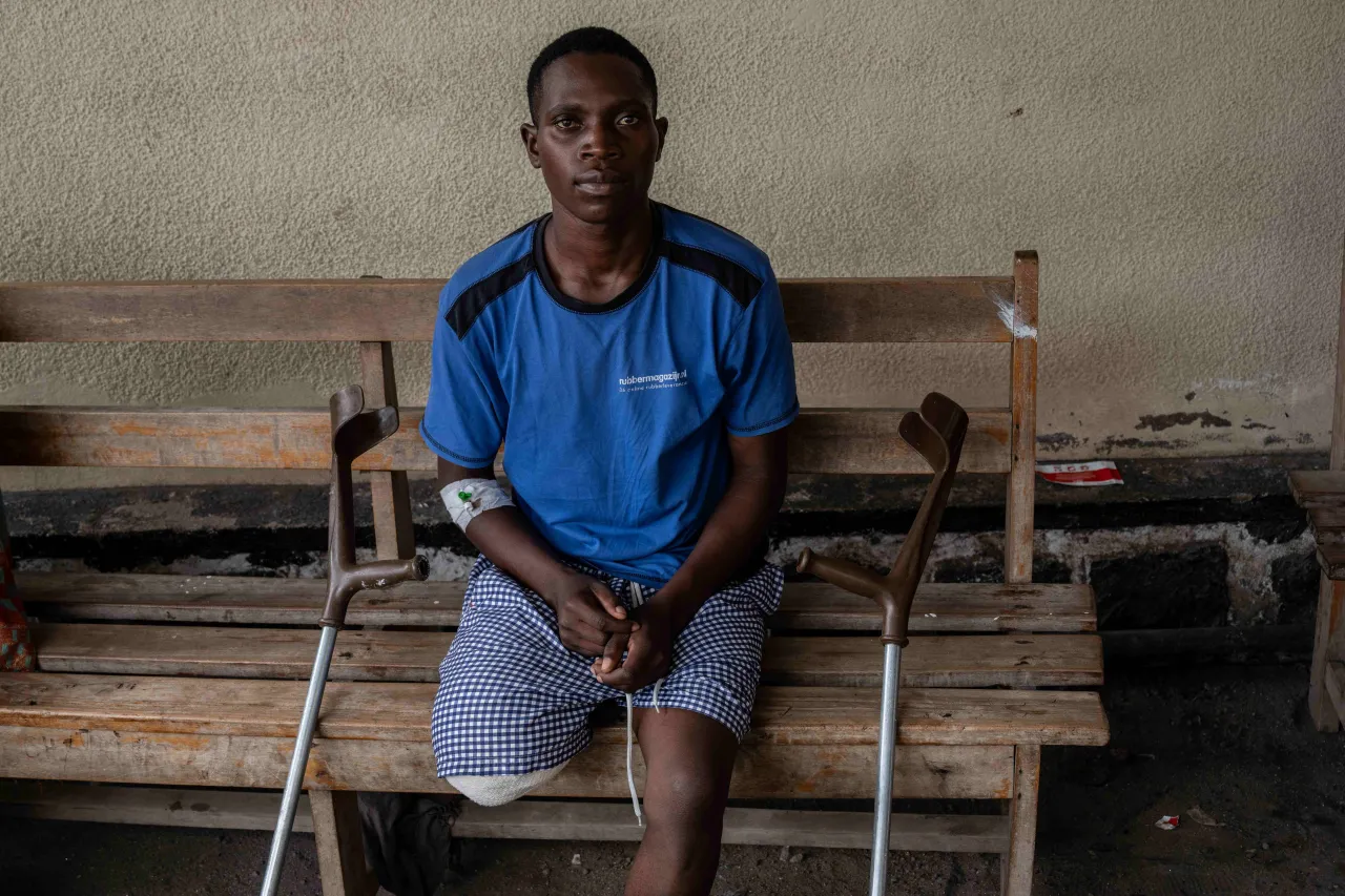 Elia Habimana, 25, had his leg amputated following a serious injury.