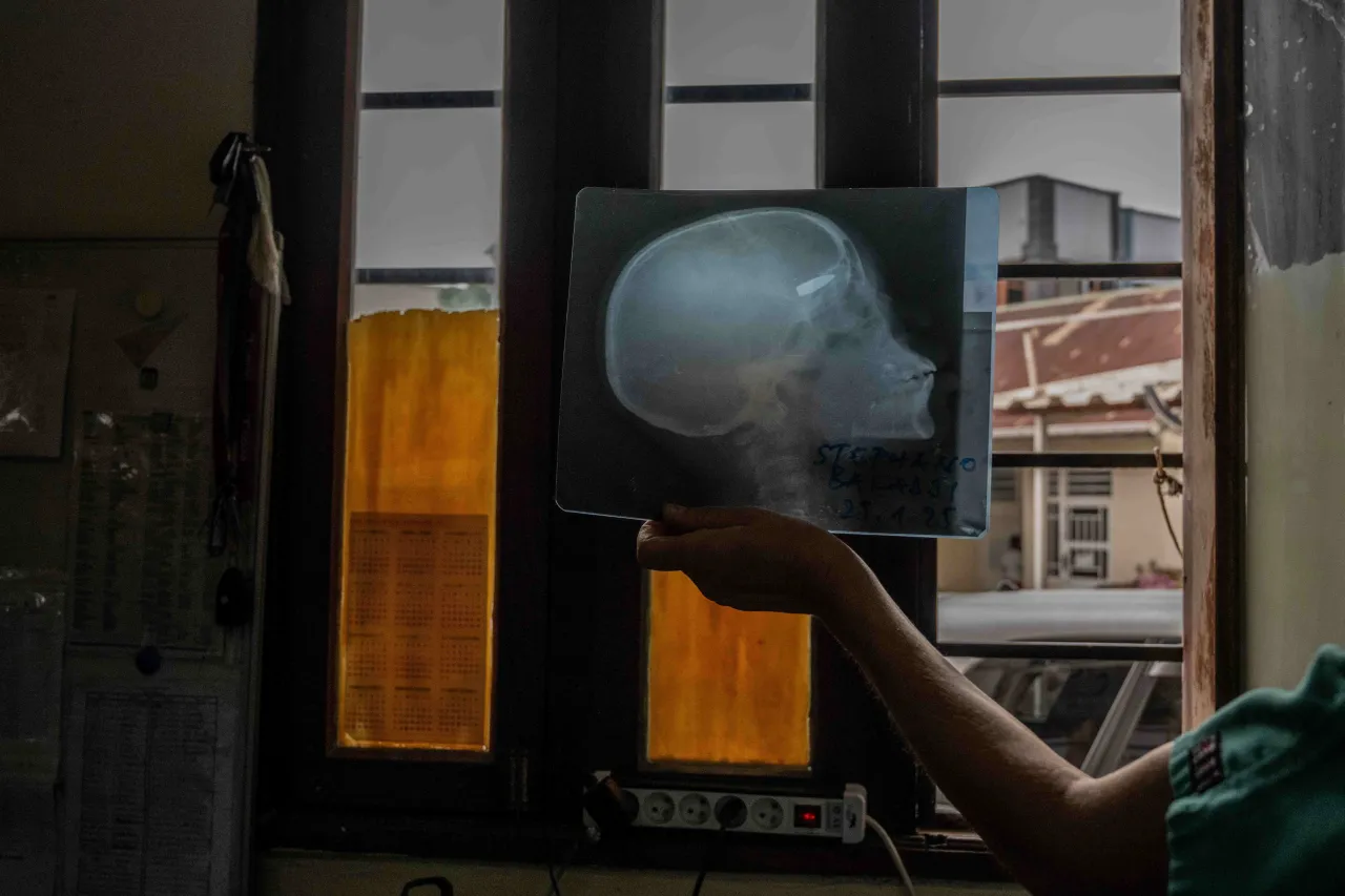 A medical staff member shows an X-ray image showing a bullet lodged in the skull.