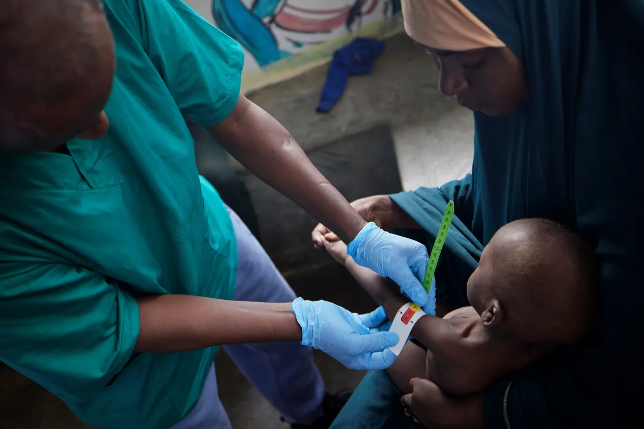 At the triage area of the stabilization centre, vital measurements such as mid-upper arm circumference (MUAC), weight, and height are taken to assess the child’s nutritional status.