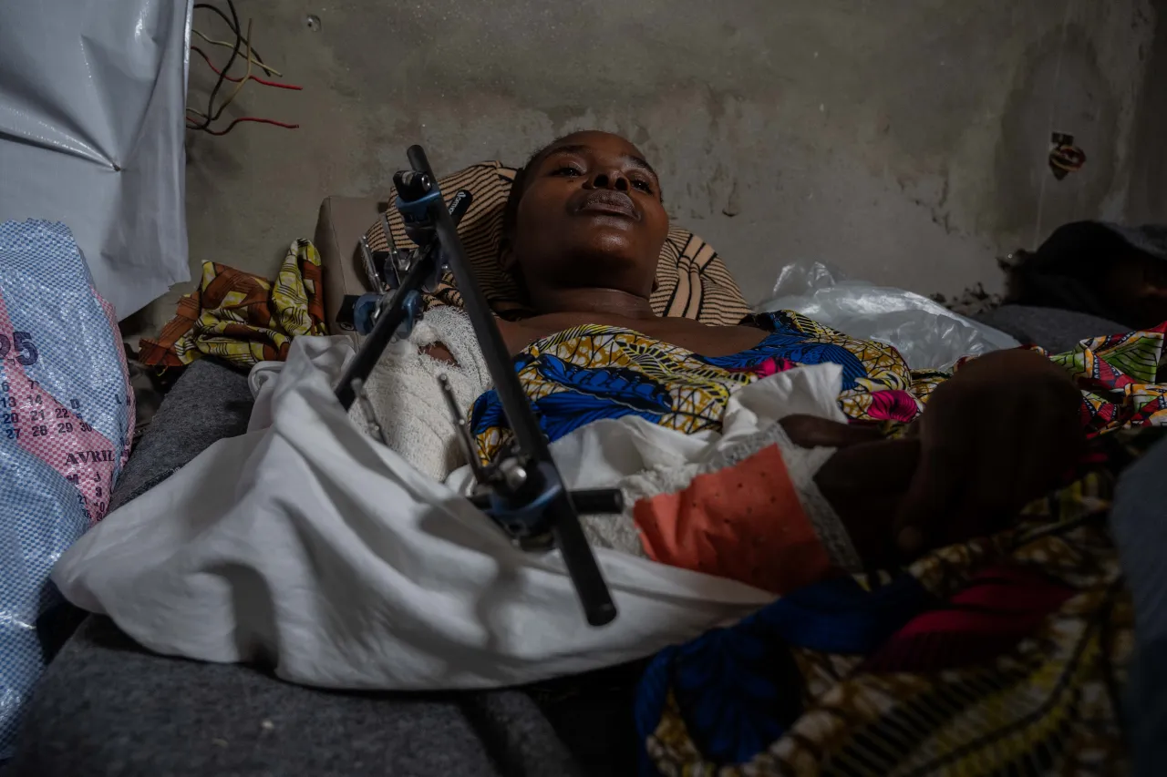 Democratic Republic of the Congo, 2025. After being severely wounded in an explosion, Riziki receives life-saving surgery at the ICRC-supported CBCA Hospital in Goma, beginning her long road to recovery. 