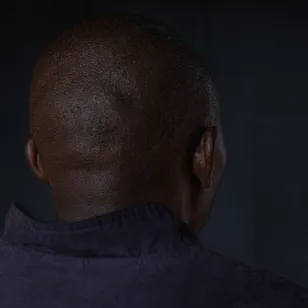 Trésor, sobreviviente de violencia sexual en la RDC. 