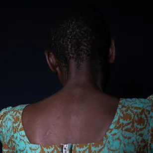 Odette, sobreviviente de violencia sexual en la RDC.