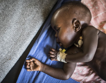 Dans les pays en conflit, la flambée des prix alimentaires entraîne une hausse des risques de malnutrition