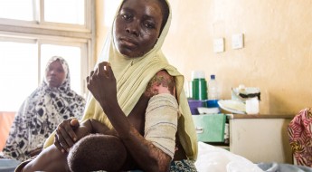 !一名严重烧伤的妇女在迈杜古里的医院为她的孩子哺乳。