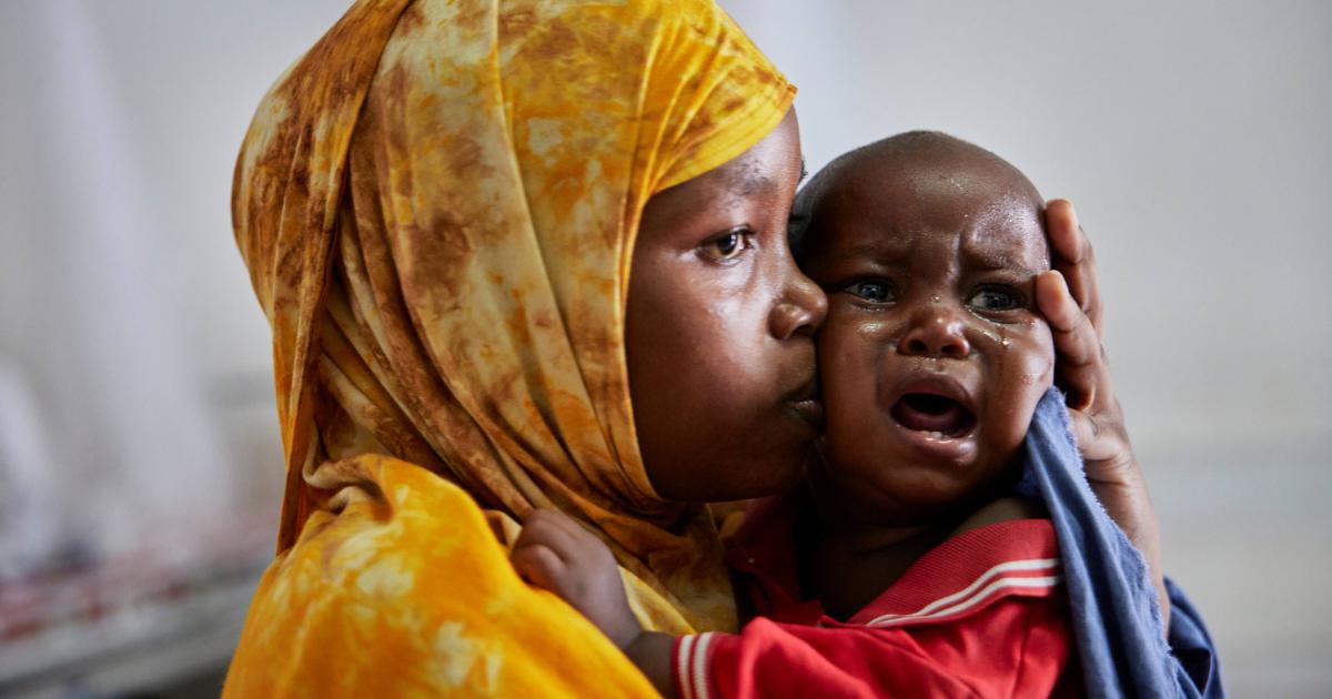 Somalia's hungry and most vulnerable: Child malnutrition surges amid clinic closures