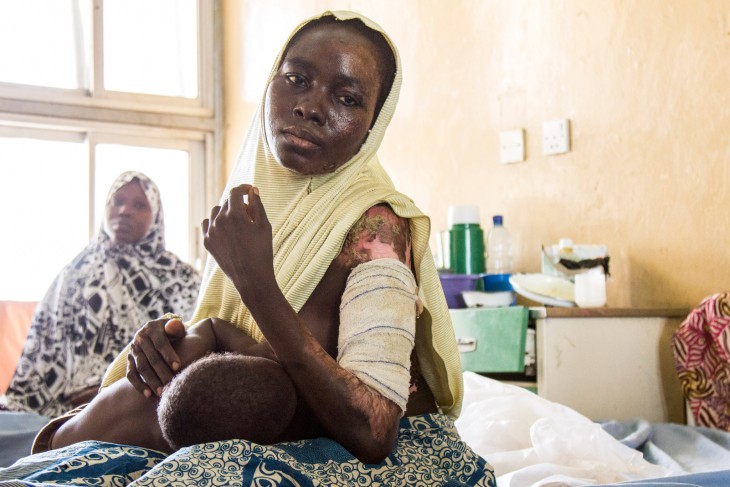 A woman badly burned as a result of the fighting in north-east Nigeria cradles her child at Maiduguri Hospital, where the ICRC is providing medical supplies and giving additional training to staff.