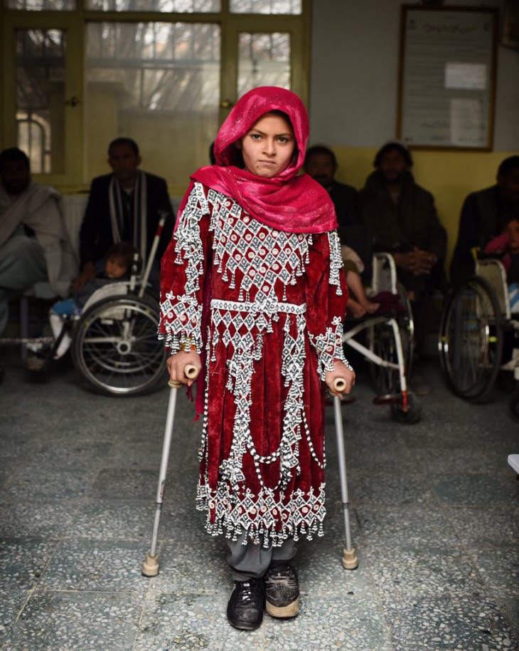 Sarzanga (8) from Ghazni province was injured by a rocket. Now she’s undergoing treatment at the ICRC’s physical rehabilitation centre in Kabul.