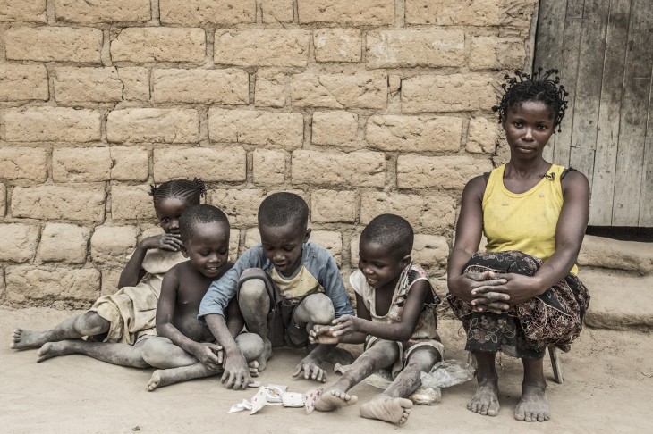 Refugiados do Congo - Mulheres, crianças e idosos são os principais afetados pela violência na República Democrática do Congo.